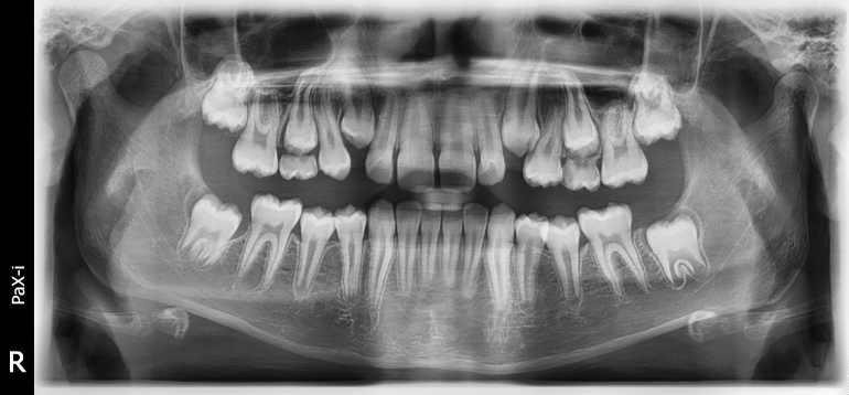 Vatech Pax-i OPG s Cephalem