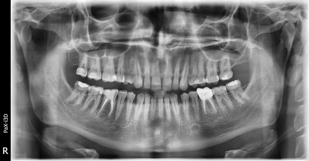 Prodej VATECH PAX I 3D 