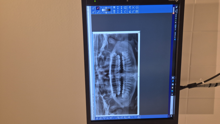 Sirona Orthophos XG (3D. Ready) OPG rok výroby 2017