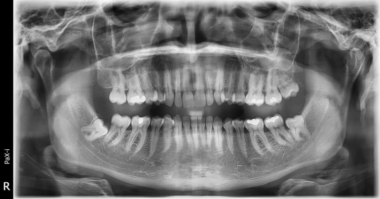 Prodám OPG Vatech PaX-i, Cena 99.000,-