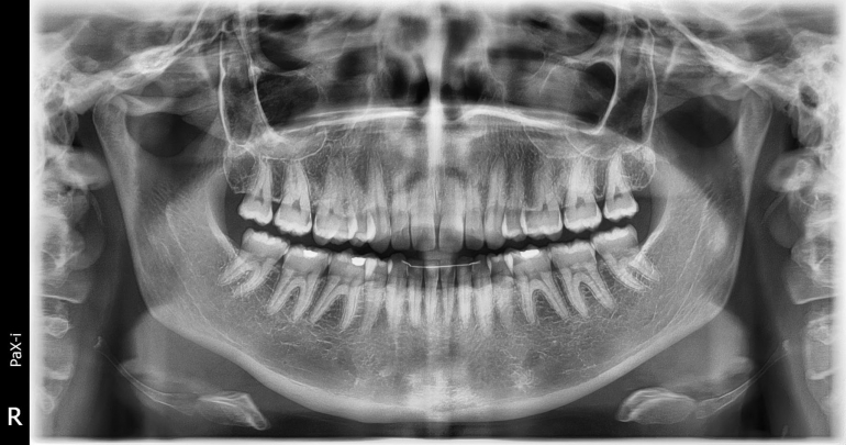 Prodám OPG Vatech PaX-i, Cena 99.000,-