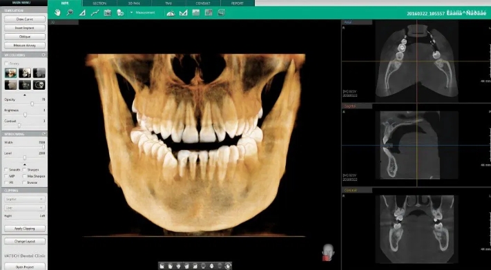 Prodej VATECH PAX I 3D 