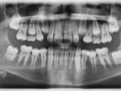 Vatech Pax-i OPG s Cephalem