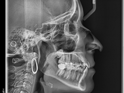 Vatech Pax-i OPG s Cephalem