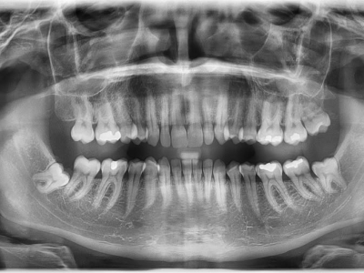 Prodám OPG Vatech PaX-i, Cena 99.000,-