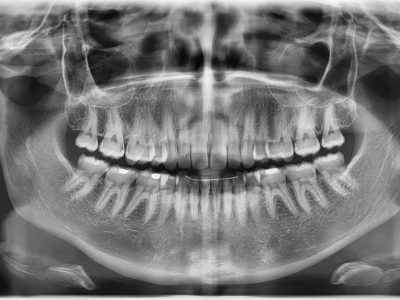 Prodám OPG Vatech PaX-i, Cena 99.000,-