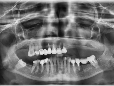 Prodám OPG Vatech PaX-i, Cena 99.000,-