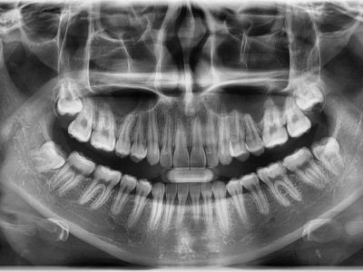 OPG Vatech Pax-i, TOP stav, aktuální model, záruka.