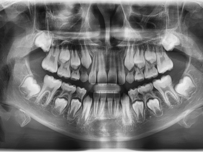 OPG Vatech Pax-i, TOP stav, aktuální model, záruka.