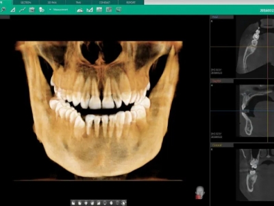 Prodej VATECH PAX I 3D 